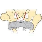 Μέτρηση ισχίων για την καταλληλότητα σέλας
