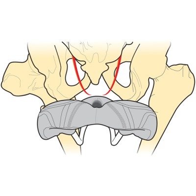 Μέτρηση ισχίων για την καταλληλότητα σέλας Μέτρηση ισχίων για την καταλληλότητα σέλας